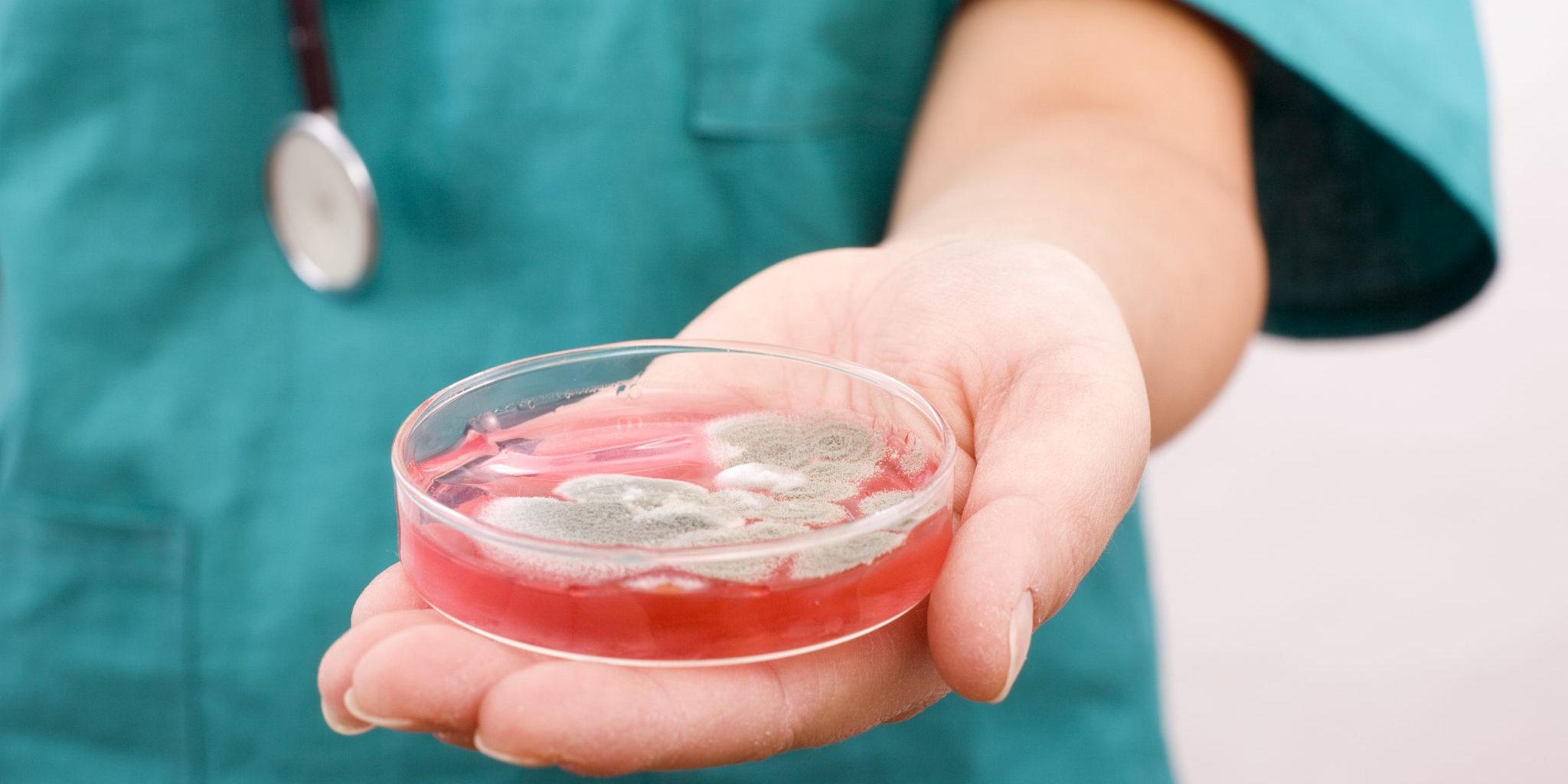 A close-up of a person wearing a nursing suit holding a Petri dish with red fluid and mould build-up.
